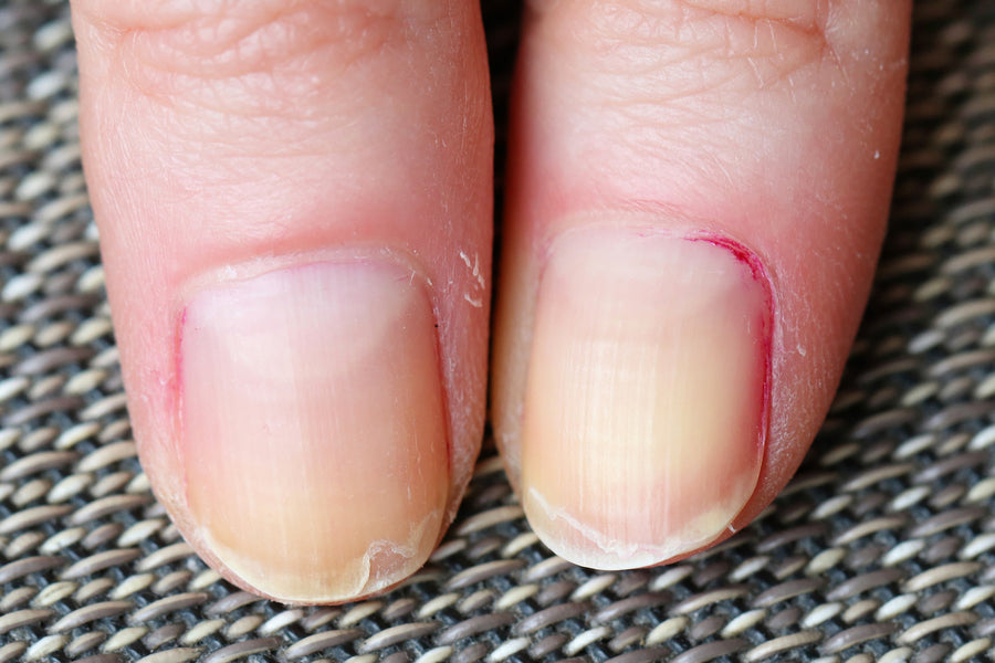 8 Things You're Doing That Are Hurting Your Nail Health & Growth